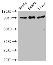 Western Blot Positive WB detected in: Mouse brain tissue, Rat heart tissue, Rat liver tissue All lanes: RPS6KA5 antibody at 3ug/ml Secondary Goat polyclonal to rabbit IgG at 1/50000 dilution Predicted band size: 90, 62, 82 kDa Observed band size: 90 kDa Western Blot Positive WB detected in: Mouse brain tissue, Rat heart tissue, Rat liver tissue All lanes: RPS6KA5 antibody at 3ug/ml Secondary Goat polyclonal to rabbit IgG at 1/50000 dilution Predicted band size: 90, 62, 82 kDa Observed band size: 90 kDa