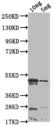 Western Blot Positive WB detected in Recombinant protein All lanes: rsad2 antibody at 1:2000 Secondary Goat polyclonal to rabbit IgG at 1/50000 dilution Predicted band size: 44.1 kDa Observed band size: 44 kDa Western Blot Positive WB detected in Recombinant protein All lanes: rsad2 antibody at 1:2000 Secondary Goat polyclonal to rabbit IgG at 1/50000 dilution Predicted band size: 44.1 kDa Observed band size: 44 kDa