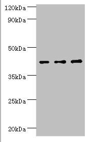 Western blot All lanes: Leukocyte elastase inhibitor antibody at 4ug/ml Lane 1: MCF-7 whole cell lysate Lane 2: Hela whole cell lysate Lane 3: HepG2 whole cell lysate Secondary Goat polyclonal to rabbit IgG at 1/10000 dilution Predicted band size: 43, 27 kDa Observed band size: 43 kDa Western blot All lanes: Leukocyte elastase inhibitor antibody at 4ug/ml Lane 1: MCF-7 whole cell lysate Lane 2: Hela whole cell lysate Lane 3: HepG2 whole cell lysate Secondary Goat polyclonal to rabbit IgG at 1/10000 dilution Predicted band size: 43, 27 kDa Observed band size: 43 kDa