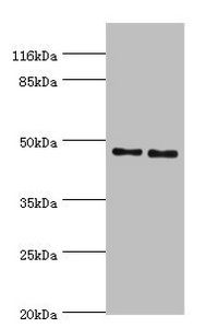 Western blot All lanes: Serpin H1 antibody at 2ug/ml Lane 1: NIH/3T3 whole cell lysate Lane 2: A2780 whole cell lysate Secondary Goat polyclonal to rabbit IgG at 1/10000 dilution Predicted band size: 46 kDa Observed band size: 46 kDa Western blot All lanes: Serpin H1 antibody at 2ug/ml Lane 1: NIH/3T3 whole cell lysate Lane 2: A2780 whole cell lysate Secondary Goat polyclonal to rabbit IgG at 1/10000 dilution Predicted band size: 46 kDa Observed band size: 46 kDa