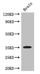 Western Blotting(WB) - SFRP1 Antibody