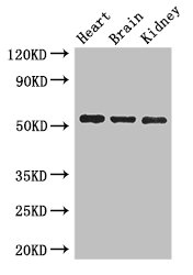 Western Blot Positive WB detected in: Mouse heart tissue, Mouse brain tissue, Mouse kidney tissue All lanes: SH3BP5 antibody at 3ug/ml Secondary Goat polyclonal to rabbit IgG at 1/50000 dilution Predicted band size: 51, 33 kDa Observed band size: 51 kDa Western Blot Positive WB detected in: Mouse heart tissue, Mouse brain tissue, Mouse kidney tissue All lanes: SH3BP5 antibody at 3ug/ml Secondary Goat polyclonal to rabbit IgG at 1/50000 dilution Predicted band size: 51, 33 kDa Observed band size: 51 kDa
