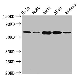 Western Blot Positive WB detected in: Hela whole cell lysate, HL60 whole cell lysate, 293T whole cell lysate, A549 whole cell lysate, Mouse kidney tissue All lanes: SLAMF6 antibody at 5.1ug/ml Secondary Goat polyclonal to rabbit IgG at 1/50000 dilution Predicted band size: 38, 25 kDa Observed band size: 60 kDa Western Blot Positive WB detected in: Hela whole cell lysate, HL60 whole cell lysate, 293T whole cell lysate, A549 whole cell lysate, Mouse kidney tissue All lanes: SLAMF6 antibody at 5.1ug/ml Secondary Goat polyclonal to rabbit IgG at 1/50000 dilution Predicted band size: 38, 25 kDa Observed band size: 60 kDa