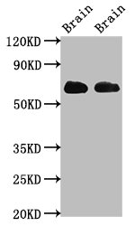 Western Blot Positive WB detected in: Rat brain tissue, Mouse brain tissue All lanes: SLC1A2 antibody at 3.2ug/ml Secondary Goat polyclonal to rabbit IgG at 1/50000 dilution Predicted band size: 63, 62 kDa Observed band size: 63 kDa Western Blot Positive WB detected in: Rat brain tissue, Mouse brain tissue All lanes: SLC1A2 antibody at 3.2ug/ml Secondary Goat polyclonal to rabbit IgG at 1/50000 dilution Predicted band size: 63, 62 kDa Observed band size: 63 kDa