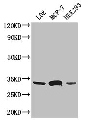 Western Blot Positive WB detected in: LO2 whole cell lysate, MCF-7 whole cell lysate, HEK293 whole cell lysate All lanes: SLC25A6 antibody at 3ug/ml Secondary Goat polyclonal to rabbit IgG at 1/50000 dilution Predicted band size: 33 kDa Observed band size: 33 kDa Western Blot Positive WB detected in: LO2 whole cell lysate, MCF-7 whole cell lysate, HEK293 whole cell lysate All lanes: SLC25A6 antibody at 3ug/ml Secondary Goat polyclonal to rabbit IgG at 1/50000 dilution Predicted band size: 33 kDa Observed band size: 33 kDa