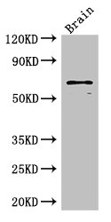 CSB-PA021701LA01HU WB