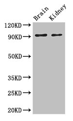 Western Blot Positive WB detected in: Mouse brain tissue, Mouse kidney tissue All lanes: SLC9A1 antibody at 3ug/ml Secondary Goat polyclonal to rabbit IgG at 1/50000 dilution Predicted band size: 91, 62 kDa Observed band size: 91 kDa Western Blot Positive WB detected in: Mouse brain tissue, Mouse kidney tissue All lanes: SLC9A1 antibody at 3ug/ml Secondary Goat polyclonal to rabbit IgG at 1/50000 dilution Predicted band size: 91, 62 kDa Observed band size: 91 kDa
