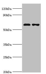 Western blot All lanes: Sterol O-acyltransferase 1 antibody at 2ug/ml Lane 1: 293T whole cell lysate Lane 2: Jurkat whole cell lysate Secondary Goat polyclonal to rabbit IgG at 1/10000 dilution Predicted band size: 65, 59, 58 kDa Observed band size: 65 kDa