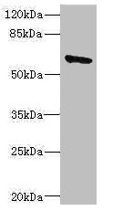 Western blot All lanes: SOCS5 antibody IgG at 1.83ug/ml + 293T whole cell lysate Secondary Goat polyclonal to rabbit IgG at 1/10000 dilution Predicted band size: 61 kDa Observed band size: 61 kDa Western blot All lanes: SOCS5 antibody IgG at 1.83ug/ml + 293T whole cell lysate Secondary Goat polyclonal to rabbit IgG at 1/10000 dilution Predicted band size: 61 kDa Observed band size: 61 kDa