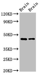 Western Blotting(WB) - SOX11 Antibody