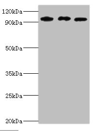 Western blot All lanes: SOX6 antibody at 10ug/ml Lane 1: Jurkat whole cell lysate Lane 2: Hela whole cell lysate Lane 3: 293T whole cell lysate Secondary Goat polyclonal to rabbit IgG at 1/10000 dilution Predicted band size: 92, 90, 89 kDa Observed band size: 92 kDa Western blot All lanes: SOX6 antibody at 10ug/ml Lane 1: Jurkat whole cell lysate Lane 2: Hela whole cell lysate Lane 3: 293T whole cell lysate Secondary Goat polyclonal to rabbit IgG at 1/10000 dilution Predicted band size: 92, 90, 89 kDa Observed band size: 92 kDa