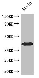 Western Blot Positive WB detected in: Mouse brain tissue All lanes: SPDEF antibody at 3ug/ml Secondary Goat polyclonal to rabbit IgG at 1/50000 dilution Predicted band size: 38, 36 kDa Observed band size: 38 kDa Western Blot Positive WB detected in: Mouse brain tissue All lanes: SPDEF antibody at 3ug/ml Secondary Goat polyclonal to rabbit IgG at 1/50000 dilution Predicted band size: 38, 36 kDa Observed band size: 38 kDa