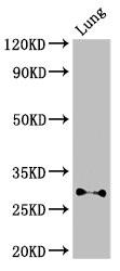 Western Blot Positive WB detected in: Mouse lung tissue All lanes: SPINT2 antibody at 3ug/ml Secondary Goat polyclonal to rabbit IgG at 1/50000 dilution Predicted band size: 29, 22 kDa Observed band size: 29 kDa Western Blot Positive WB detected in: Mouse lung tissue All lanes: SPINT2 antibody at 3ug/ml Secondary Goat polyclonal to rabbit IgG at 1/50000 dilution Predicted band size: 29, 22 kDa Observed band size: 29 kDa