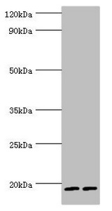 Western blot All lanes: Serglycin antibody at 9ug/ml Lane 1: THP-1 whole cell lysate Lane 2: HL60 whole cell lysate Secondary Goat polyclonal to rabbit IgG at 1/10000 dilution Predicted band size: 18 kDa Observed band size: 18 kDa Western blot All lanes: Serglycin antibody at 9ug/ml Lane 1: THP-1 whole cell lysate Lane 2: HL60 whole cell lysate Secondary Goat polyclonal to rabbit IgG at 1/10000 dilution Predicted band size: 18 kDa Observed band size: 18 kDa