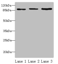 Western blot All lanes: STAT5B antibody at 16 ug/ml Lane 1: HepG2 whole cell lysate Lane 2: K562 whole cell lysate Lane 3: Hela whole cell lysate Secondary Goat polyclonal to rabbit IgG at 1/10000 dilution Predicted band size: 90 kDa Observed band size: 90 kDa Western blot All lanes: STAT5B antibody at 16 ug/ml Lane 1: HepG2 whole cell lysate Lane 2: K562 whole cell lysate Lane 3: Hela whole cell lysate Secondary Goat polyclonal to rabbit IgG at 1/10000 dilution Predicted band size: 90 kDa Observed band size: 90 kDa