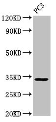 Western Blot Positive WB detected in: PC-3 whole cell lysate All lanes: STX1A antibody at 3ug/ml Secondary Goat polyclonal to rabbit IgG at 1/50000 dilution Predicted band size: 34, 30, 29 kDa Observed band size: 34 kDa Western Blot Positive WB detected in: PC-3 whole cell lysate All lanes: STX1A antibody at 3ug/ml Secondary Goat polyclonal to rabbit IgG at 1/50000 dilution Predicted band size: 34, 30, 29 kDa Observed band size: 34 kDa