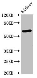 Western Blot Positive WB detected in: Mouse kidney tissue All lanes: STXBP3 antibody at 3.4ug/ml Secondary Goat polyclonal to rabbit IgG at 1/50000 dilution Predicted band size: 68 kDa Observed band size: 68 kDa Western Blot Positive WB detected in: Mouse kidney tissue All lanes: STXBP3 antibody at 3.4ug/ml Secondary Goat polyclonal to rabbit IgG at 1/50000 dilution Predicted band size: 68 kDa Observed band size: 68 kDa