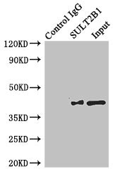 Immunoprecipitating SULT2B1 in MCF-7 whole cell lysate Lane 1: Rabbit control IgG instead of (1ug) instead of CSB-PA022943ESR2HU in MCF-7 whole cell lysate. For western blotting, a HRP-conjugated anti-rabbit IgG, specific to the non-reduced form of IgG was used as the Secondary antibody (1/50000) Lane 2: CSB-PA022943ESR2HU (4ug) + MCF-7 whole cell lysate (500ug) Lane 3: MCF-7 whole cell lysate (20ug)