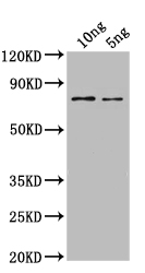 Western Blot Positive WB detected in: recombinant protein All lanes: SPT16 Antibody at 1:1000 Secondary Goat polyclonal to rabbit IgG at 1/50000 dilution Predicted band size: 65 kDa Observed band size: 65 kDa Western Blot Positive WB detected in: recombinant protein All lanes: SPT16 Antibody at 1:1000 Secondary Goat polyclonal to rabbit IgG at 1/50000 dilution Predicted band size: 65 kDa Observed band size: 65 kDa
