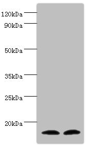 Western blot All lanes: Protachykinin-1 antibody at 6ug/ml Lane 1: Mouse liver tissue Lane 2: 293T whole cell lysate Secondary Goat polyclonal to rabbit IgG at 1/10000 dilution Predicted band size: 16, 14, 12 kDa Observed band size: 16 kDa Western blot All lanes: Protachykinin-1 antibody at 6ug/ml Lane 1: Mouse liver tissue Lane 2: 293T whole cell lysate Secondary Goat polyclonal to rabbit IgG at 1/10000 dilution Predicted band size: 16, 14, 12 kDa Observed band size: 16 kDa