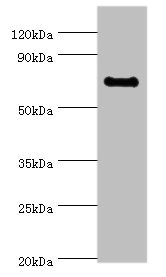 Western blot All lanes: TAF5L antibody at 10ug/ml + Jurkat whole cell lysate Secondary Goat polyclonal to rabbit IgG at 1/10000 dilution Predicted band size: 67, 37 kDa Observed band size: 67 kDa Western blot All lanes: TAF5L antibody at 10ug/ml + Jurkat whole cell lysate Secondary Goat polyclonal to rabbit IgG at 1/10000 dilution Predicted band size: 67, 37 kDa Observed band size: 67 kDa