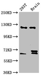 Western Blot Positive WB detected in: 293T whole cell lysate, Rat brain tissue All lanes: TCERG1 antibody at 5.9ug/ml Secondary Goat polyclonal to rabbit IgG at 1/50000 dilution Predicted band size: 124, 122 kDa Observed band size: 124 kDa Western Blot Positive WB detected in: 293T whole cell lysate, Rat brain tissue All lanes: TCERG1 antibody at 5.9ug/ml Secondary Goat polyclonal to rabbit IgG at 1/50000 dilution Predicted band size: 124, 122 kDa Observed band size: 124 kDa