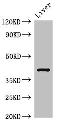 Western Blot Positive WB detected in: Rat liver tissue All lanes: TGDS antibody at 3ug/ml Secondary Goat polyclonal to rabbit IgG at 1/50000 dilution Predicted band size: 41 kDa Observed band size: 41 kDa