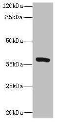 Western blot All lanes: TMEM64 antibody at 8microg/ml + Mouse brain tissue Secondary Goat polyclonal to rabbit IgG at 1/10000 dilution Predicted band size: 40, 13, 15, 34 kDa Observed band size: 40 kDa Western blot All lanes: TMEM64 antibody at 8microg/ml + Mouse brain tissue Secondary Goat polyclonal to rabbit IgG at 1/10000 dilution Predicted band size: 40, 13, 15, 34 kDa Observed band size: 40 kDa