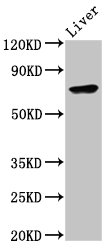 Western Blot Positive WB detected in: Mouse liver tissue All lanes: TNFAIP2 antibody at 6.9ug/ml Secondary Goat polyclonal to rabbit IgG at 1/50000 dilution Predicted band size: 73 kDa Observed band size: 73 kDa Western Blot Positive WB detected in: Mouse liver tissue All lanes: TNFAIP2 antibody at 6.9ug/ml Secondary Goat polyclonal to rabbit IgG at 1/50000 dilution Predicted band size: 73 kDa Observed band size: 73 kDa