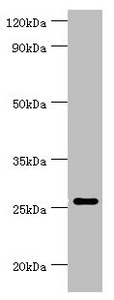 Western blot All lanes: Tumor necrosis factor ligand superfamily member 13 antibody at 10ug/ml + Hela whole cell lysate Secondary Goat polyclonal to rabbit IgG at 1/10000 dilution Predicted band size: 28, 26, 25, 37, 23 kDa Observed band size: 28 kDa Western blot All lanes: Tumor necrosis factor ligand superfamily member 13 antibody at 10ug/ml + Hela whole cell lysate Secondary Goat polyclonal to rabbit IgG at 1/10000 dilution Predicted band size: 28, 26, 25, 37, 23 kDa Observed band size: 28 kDa