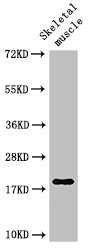 Western Blot Positive WB detected in: Rat skeletal muscle tissue All lanes: TNNC1 antibody at 3ug/ml Secondary Goat polyclonal to rabbit IgG at 1/50000 dilution Predicted band size: 19 kDa Observed band size: 19 kDa Western Blot Positive WB detected in: Rat skeletal muscle tissue All lanes: TNNC1 antibody at 3ug/ml Secondary Goat polyclonal to rabbit IgG at 1/50000 dilution Predicted band size: 19 kDa Observed band size: 19 kDa