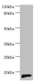 Western blot All lanes: TNNC2 antibody at 10ug/ml + Mouse skeletal muscle tissue Secondary Goat polyclonal to rabbit IgG at 1/10000 dilution Predicted band size: 18 kDa Observed band size: 18 kDa Western blot All lanes: TNNC2 antibody at 10ug/ml + Mouse skeletal muscle tissue Secondary Goat polyclonal to rabbit IgG at 1/10000 dilution Predicted band size: 18 kDa Observed band size: 18 kDa