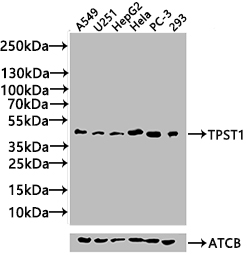 Western Blot Positive WB detected in: Rat liver tissue, Mouse liver tissue, Mouse kidney tissue All lanes: TPST1 antibody at 2.4ug/ml Secondary Goat polyclonal to rabbit IgG at 1/50000 dilution Predicted band size: 43 kDa Observed band size: 50 kDa
