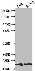 Western Blot Positive WB detected in Recombinant protein All lanes: TRBC2 antibody at 1:2000 Secondary Goat polyclonal to rabbit IgG at 1/50000 dilution Predicted band size: 19.7 kDa Observed band size: 20 kDa Western Blot Positive WB detected in Recombinant protein All lanes: TRBC2 antibody at 1:2000 Secondary Goat polyclonal to rabbit IgG at 1/50000 dilution Predicted band size: 19.7 kDa Observed band size: 20 kDa