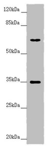 Western blot All lanes: TRIM23 antibody at 4.55 ug/ml + Raw264.7 whole cell lysate Secondary Goat polyclonal to rabbit IgG at 1/10000 dilution Predicted band size: 65, 64, 62 kDa Observed band size: 65, 35 kDa Western blot All lanes: TRIM23 antibody at 4.55 ug/ml + Raw264.7 whole cell lysate Secondary Goat polyclonal to rabbit IgG at 1/10000 dilution Predicted band size: 65, 64, 62 kDa Observed band size: 65, 35 kDa