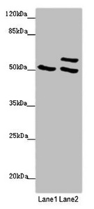 Western blot All lanes: TUBB4A antibody at 2 ug/ml Lane 1: 293T whole cell lysate Lane 2: Hela whole cell lysate Secondary Goat polyclonal to rabbit IgG at 1/10000 dilution Predicted band size: 50 kDa Observed band size: 50, 58 kDa