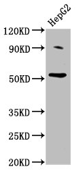 Western Blot Positive WB detected in: HepG2 whole cell lysate All lanes: U2AF2 antibody at 2ug/ml Secondary Goat polyclonal to rabbit IgG at 1/50000 dilution Predicted band size: 54 kDa Observed band size: 54 kDa Western Blot Positive WB detected in: HepG2 whole cell lysate All lanes: U2AF2 antibody at 2ug/ml Secondary Goat polyclonal to rabbit IgG at 1/50000 dilution Predicted band size: 54 kDa Observed band size: 54 kDa