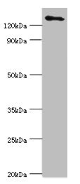 Western blot All lanes: USP8 antibody at 14ug/ml + 293T whole cell lysate Secondary Goat polyclonal to rabbit IgG at 1/10000 dilution Predicted band size: 128, 116 kDa Observed band size: 128 kDa Western blot All lanes: USP8 antibody at 14ug/ml + 293T whole cell lysate Secondary Goat polyclonal to rabbit IgG at 1/10000 dilution Predicted band size: 128, 116 kDa Observed band size: 128 kDa