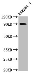 Western Blot Positive WB detected in: Raw264.7 whole cell lysate All lanes: VCP antibody at 3ug/ml Secondary Goat polyclonal to rabbit IgG at 1/50000 dilution Predicted band size: 90 kDa Observed band size: 90 kDa Western Blot Positive WB detected in: Raw264.7 whole cell lysate All lanes: VCP antibody at 3ug/ml Secondary Goat polyclonal to rabbit IgG at 1/50000 dilution Predicted band size: 90 kDa Observed band size: 90 kDa