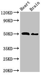 Western Blot Positive WB detected in: Mouse heart tissue, Mouse brain tissue All lanes: VPS4B antibody at 2.5ug/ml Secondary Goat polyclonal to rabbit IgG at 1/50000 dilution Predicted band size: 50 kDa Observed band size: 50 kDa