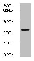Western blot All lanes: VSX1 antibody IgG at 2.32ug/ml + 293T whole cell lysate Secondary Goat polyclonal to rabbit IgG at 1/10000 dilution Predicted band size: 39, 25, 40, 15, 30, 23, 25, 33 kDa Observed band size: 39 kDa Western blot All lanes: VSX1 antibody IgG at 2.32ug/ml + 293T whole cell lysate Secondary Goat polyclonal to rabbit IgG at 1/10000 dilution Predicted band size: 39, 25, 40, 15, 30, 23, 25, 33 kDa Observed band size: 39 kDa