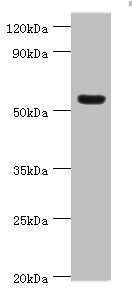Western blot All lanes: Vitronectin antibody at 12ug/ml + HepG2 whole cell lysate Secondary Goat polyclonal to rabbit IgG at 1/10000 dilution Predicted band size: 54 kDa Observed band size: 54 kDa Western blot All lanes: Vitronectin antibody at 12ug/ml + HepG2 whole cell lysate Secondary Goat polyclonal to rabbit IgG at 1/10000 dilution Predicted band size: 54 kDa Observed band size: 54 kDa