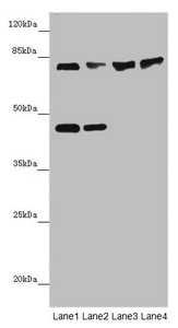 Western blot All lanes: ZNF169antibody at 2ug/ml Lane 1: HepG2 whole cell lysate Lane 2: Hela whole cell lysate Lane 3: Mouse liver tissue Lane 4: Mouse kidney tissue Secondary Goat polyclonal to rabbit IgG at 1/10000 dilution Predicted band size: 68 kDa Observed band size: 68, 45 kDa Western blot All lanes: ZNF169antibody at 2ug/ml Lane 1: HepG2 whole cell lysate Lane 2: Hela whole cell lysate Lane 3: Mouse liver tissue Lane 4: Mouse kidney tissue Secondary Goat polyclonal to rabbit IgG at 1/10000 dilution Predicted band size: 68 kDa Observed band size: 68, 45 kDa