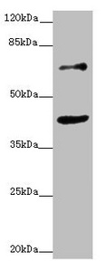 Western blot All lanes: ZNF20 antibody at 2.53ug/ml + MCF-7 whole cell lysate Secondary Goat polyclonal to rabbit IgG at 1/10000 dilution Predicted band size: 62 kDa Observed band size: 62, 40 kDa Western blot All lanes: ZNF20 antibody at 2.53ug/ml + MCF-7 whole cell lysate Secondary Goat polyclonal to rabbit IgG at 1/10000 dilution Predicted band size: 62 kDa Observed band size: 62, 40 kDa
