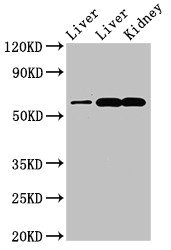 Western Blot Positive WB detected in: Rat liver tissue, Mouse liver tissue, Mouse kidney tissue All lanes: ZNF695 antibody at 3.4ug/ml Secondary Goat polyclonal to rabbit IgG at 1/50000 dilution Predicted band size: 61, 21, 16, 11 kDa Observed band size: 61 kDa Western Blot Positive WB detected in: Rat liver tissue, Mouse liver tissue, Mouse kidney tissue All lanes: ZNF695 antibody at 3.4ug/ml Secondary Goat polyclonal to rabbit IgG at 1/50000 dilution Predicted band size: 61, 21, 16, 11 kDa Observed band size: 61 kDa