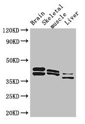 Western Blot Positive WB detected in: Mouse brain tissue, Mouse skeletal muscle tissue, Mouse liver tissue All lanes: ALDOC antibody at 3ug/ml Secondary Goat polyclonal to rabbit IgG at 1/50000 dilution Predicted band size: 40 kDa Observed band size: 40, 36, 42 kDa