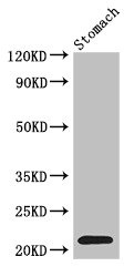 Western Blot Positive WB detected in: Mouse stomach tissue All lanes: IFN-alpha antibody at 3ug/ml Secondary Goat polyclonal to rabbit IgG at 1/50000 dilution predicted band size: 22 kDa observed band size: 22 kDa Western Blot Positive WB detected in: Mouse stomach tissue All lanes: IFN-alpha antibody at 3ug/ml Secondary Goat polyclonal to rabbit IgG at 1/50000 dilution predicted band size: 22 kDa observed band size: 22 kDa