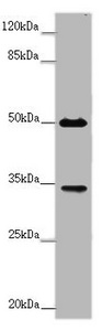 Western Blotting(WB) - FCGR2B Antibody