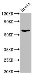 Western Blot Positive WB detected in: Rat brain tissue All lanes: HEXA antibody at 5.8ug/ml Secondary Goat polyclonal to rabbit IgG at 1/50000 dilution Predicted band size: 61, 20 kDa Observed band size: 61 kDa