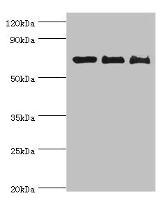 CSB-PA326953ESR1HU WB